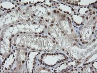 Immunohistochemistry: LMO2 Antibody (OTI1G10) [NBP2-45787]