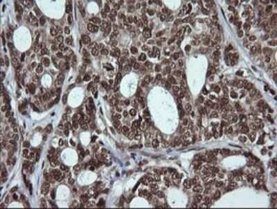 Immunohistochemistry: LMO2 Antibody (OTI1G10) [NBP2-45787]