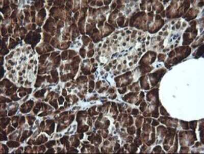 Immunohistochemistry: LMO2 Antibody (OTI1G10) [NBP2-45787]