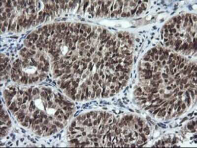 Immunohistochemistry: LMO2 Antibody (OTI1G10) [NBP2-45787]