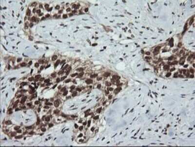 Immunohistochemistry: LMO2 Antibody (OTI1G10) [NBP2-45787]