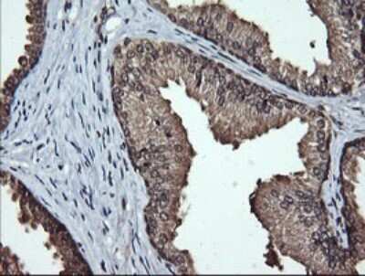 Immunohistochemistry: LMO2 Antibody (OTI1G10) [NBP2-45787]