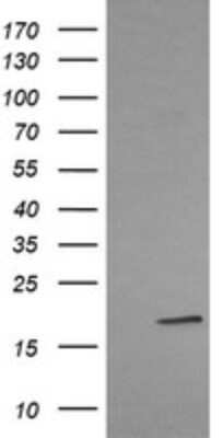 Western Blot: LMO2 Antibody (OTI1G10) [NBP2-45787]