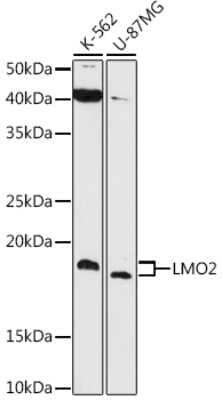 Western Blot: LMO2 Antibody (9O5X9) [NBP3-16647]