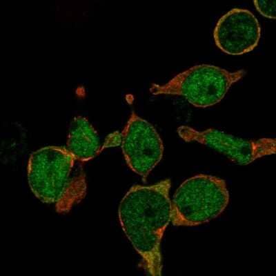 Immunocytochemistry/ Immunofluorescence: LMO2 Antibody [NBP2-58513]