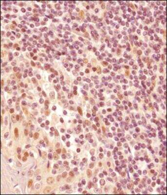 Immunohistochemistry-Paraffin: LMO2 Antibody - BSA Free [NB110-83978]