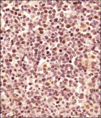 Immunohistochemistry-Paraffin: LMO2 Antibody - BSA Free [NB110-83978]