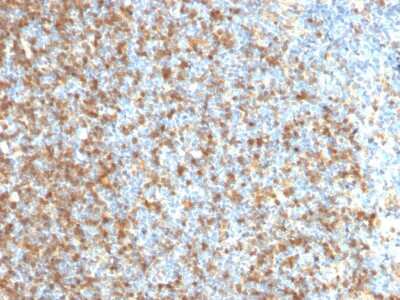 Immunohistochemistry-Paraffin: LMO2 Antibody (LMO2/1971) - Azide and BSA Free [NBP3-08268]
