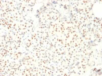 Immunohistochemistry-Paraffin: LMO2 Antibody (LMO2/1971) [NBP3-07249]