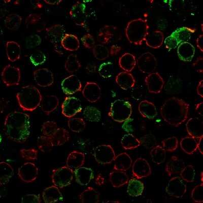 Immunocytochemistry/ Immunofluorescence: LMO2 Antibody (LMO2/3147R) - Azide and BSA Free [NBP3-08945]