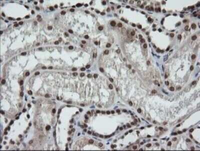 Immunohistochemistry: LMO2 Antibody (OTI1G10) - Azide and BSA Free [NBP2-71157]