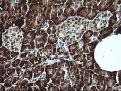 Immunohistochemistry: LMO2 Antibody (OTI1G10) - Azide and BSA Free [NBP2-71157]