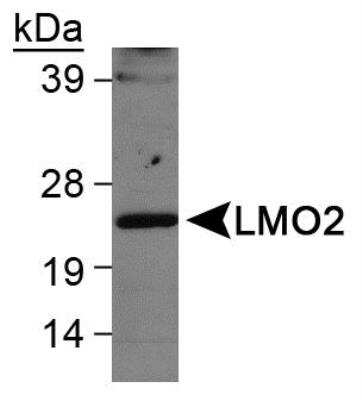 Western Blot: LMO2 AntibodyBSA Free [NB110-83978]