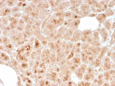 Immunohistochemistry-Paraffin: LMO2 Antibody (rLMO2/1971) - Azide and BSA Free [NBP3-08285]