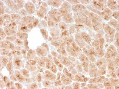 Immunohistochemistry-Paraffin: LMO2 Antibody (rLMO2/1971) - Azide and BSA Free [NBP3-08285]