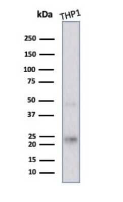 Western Blot: LMO2 Antibody (rLMO2/1971)Azide and BSA Free [NBP3-08285]