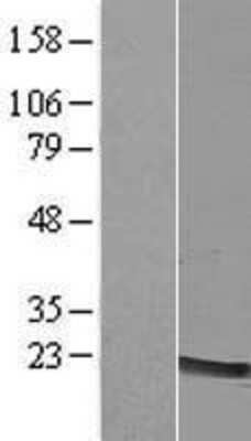 Western Blot: LMO2 Overexpression Lysate [NBP2-07732]