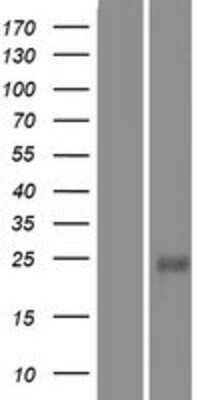 Western Blot: LMO2 Overexpression Lysate [NBP2-10225]