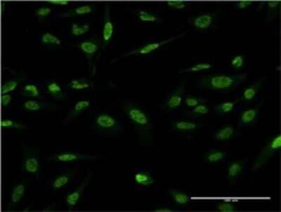 Immunocytochemistry/ Immunofluorescence: LMO4 Antibody (2B6) [H00008543-M02]