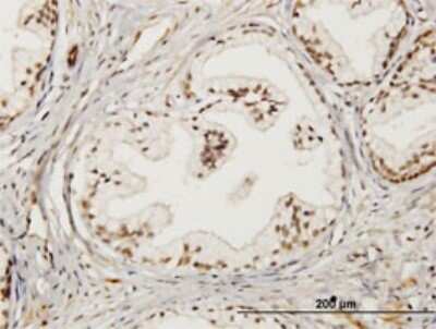 Immunohistochemistry-Paraffin: LMO4 Antibody (2B6) [H00008543-M02]
