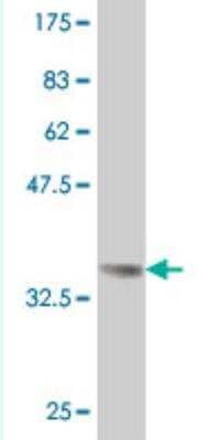 Western Blot: LMO4 Antibody (3B4) [H00008543-M04]