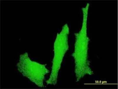 Immunocytochemistry/ Immunofluorescence: LMO4 Antibody (4H8) [H00008543-M01]