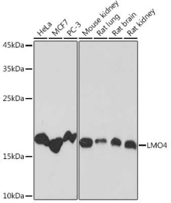 Western Blot: LMO4 Antibody (5C0I1) [NBP3-16630]