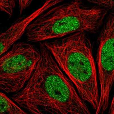 Immunocytochemistry/ Immunofluorescence: LMO4 Antibody [NBP2-49342]