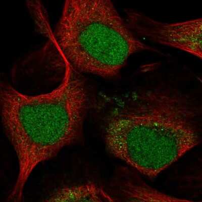 Immunocytochemistry/ Immunofluorescence: LMO4 Antibody [NBP2-58657]