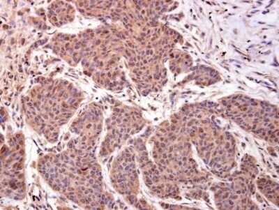 Immunohistochemistry-Paraffin: LMO4 Antibody [NBP2-43538]