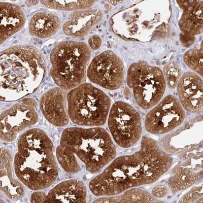 Immunohistochemistry-Paraffin: LMO4 Antibody [NBP2-49342]