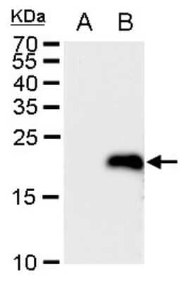 Western Blot: LMO4 Antibody [NBP2-43538]