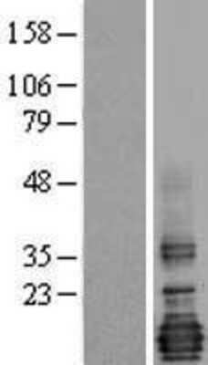 Western Blot: LMO4 Overexpression Lysate [NBL1-12568]