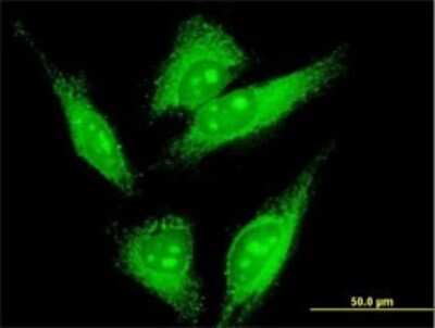 Immunocytochemistry/ Immunofluorescence: LMO7 Antibody (4B4) [H00004008-M01]