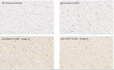 Immunohistochemistry: LMO7 Antibody [NBP1-83915]