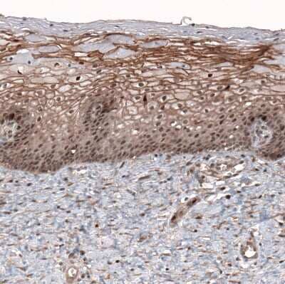 Immunohistochemistry-Paraffin: LMO7 Antibody [NBP1-83915]