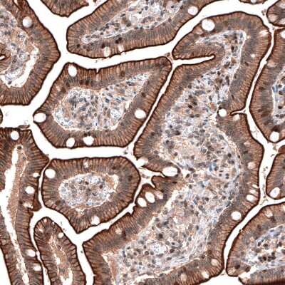 Immunohistochemistry-Paraffin: LMO7 Antibody [NBP1-83915]