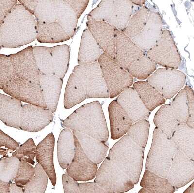 Immunohistochemistry-Paraffin: LMO7 Antibody [NBP1-83915]