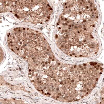 Immunohistochemistry-Paraffin: LMO7 Antibody [NBP1-83915]