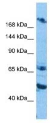 Western Blot: LMO7 Antibody [NBP3-09978]