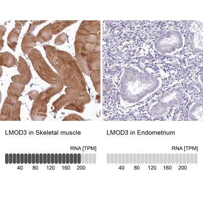 Immunohistochemistry-Paraffin: LMOD3 Antibody [NBP1-85898]