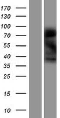 Western Blot: LMOD3 Overexpression Lysate [NBP2-04715]