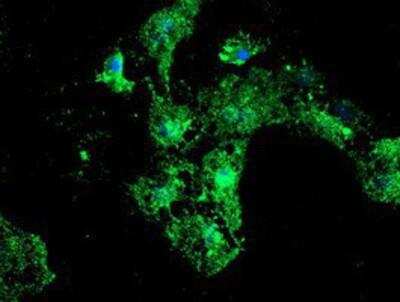 Immunocytochemistry/ Immunofluorescence: LMP2/PSMB9 Antibody (OTI1D1) [NBP2-01817]