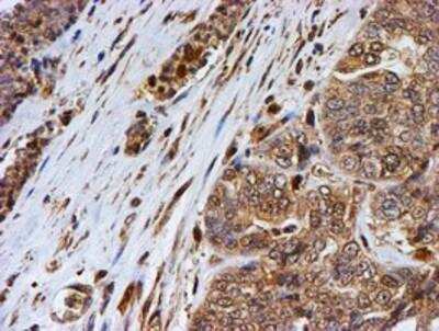 Immunohistochemistry-Paraffin: LMP2/PSMB9 Antibody (OTI1D1) [NBP2-01817]