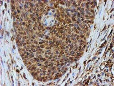 Immunohistochemistry-Paraffin: LMP2/PSMB9 Antibody (OTI1D1) [NBP2-01817]