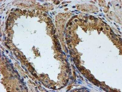 Immunohistochemistry-Paraffin: LMP2/PSMB9 Antibody (OTI1D1) [NBP2-01817]