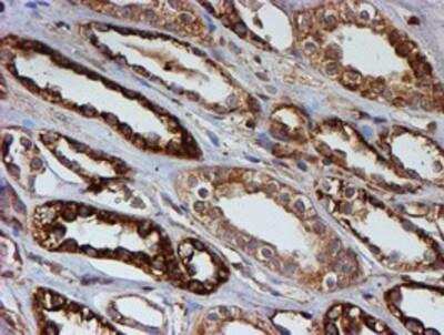 Immunohistochemistry-Paraffin: LMP2/PSMB9 Antibody (OTI1D1) [NBP2-01817]