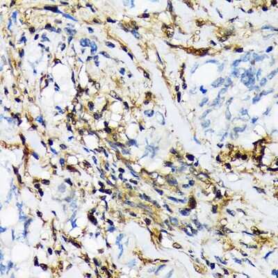Immunohistochemistry-Paraffin: LMP2/PSMB9 Antibody (7Q2G4) [NBP3-16823]
