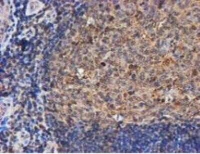 Immunohistochemistry: LMP2/PSMB9 Antibody (OTI1D1) - Azide and BSA Free [NBP2-71261]