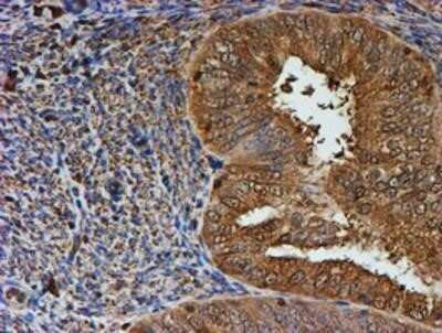 Immunohistochemistry: LMP2/PSMB9 Antibody (OTI1D1) - Azide and BSA Free [NBP2-71261]